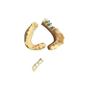 China FDA 3D Printed Dental Models Dental Crown Porcelain Fused To Metal wholesale