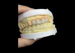 Stain Resistant Dental Porcelain Crowns and Bridges in Vita Classical Shades for