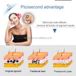 Epilator Clinical Diode Laser Hair Removal System Stationary Diode 808 Laser