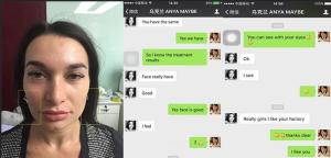 China Good feedback and customers satisfy HIFU face lifting / wrinkle removal Beijing leadbeauty company beauty machine wholesale