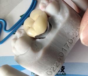 China Dental Lab Product CAD CAM PFM Crown porcelain fused to metal wholesale