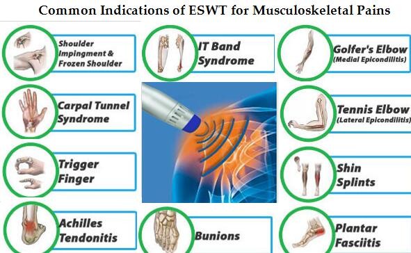 Facture price eswt shock wave therapy equipment for beauty clinic use