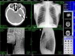 Diagnostic Laser X Ray Dry Film Medical For AGFA / Fuji Printer