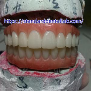 China Dental Implant Temporary Crown PMMA Bridge With Pink Porcelian wholesale