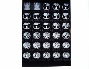 China High Density Digital X Ray Film wholesale