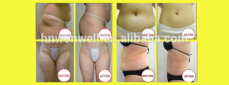 Laser cellulite loss slimming machine