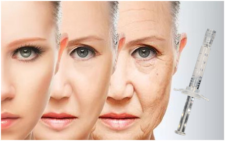 Stimulating Collagen PCL Skin Booster Syringe Polycaprolactone Based 2ml