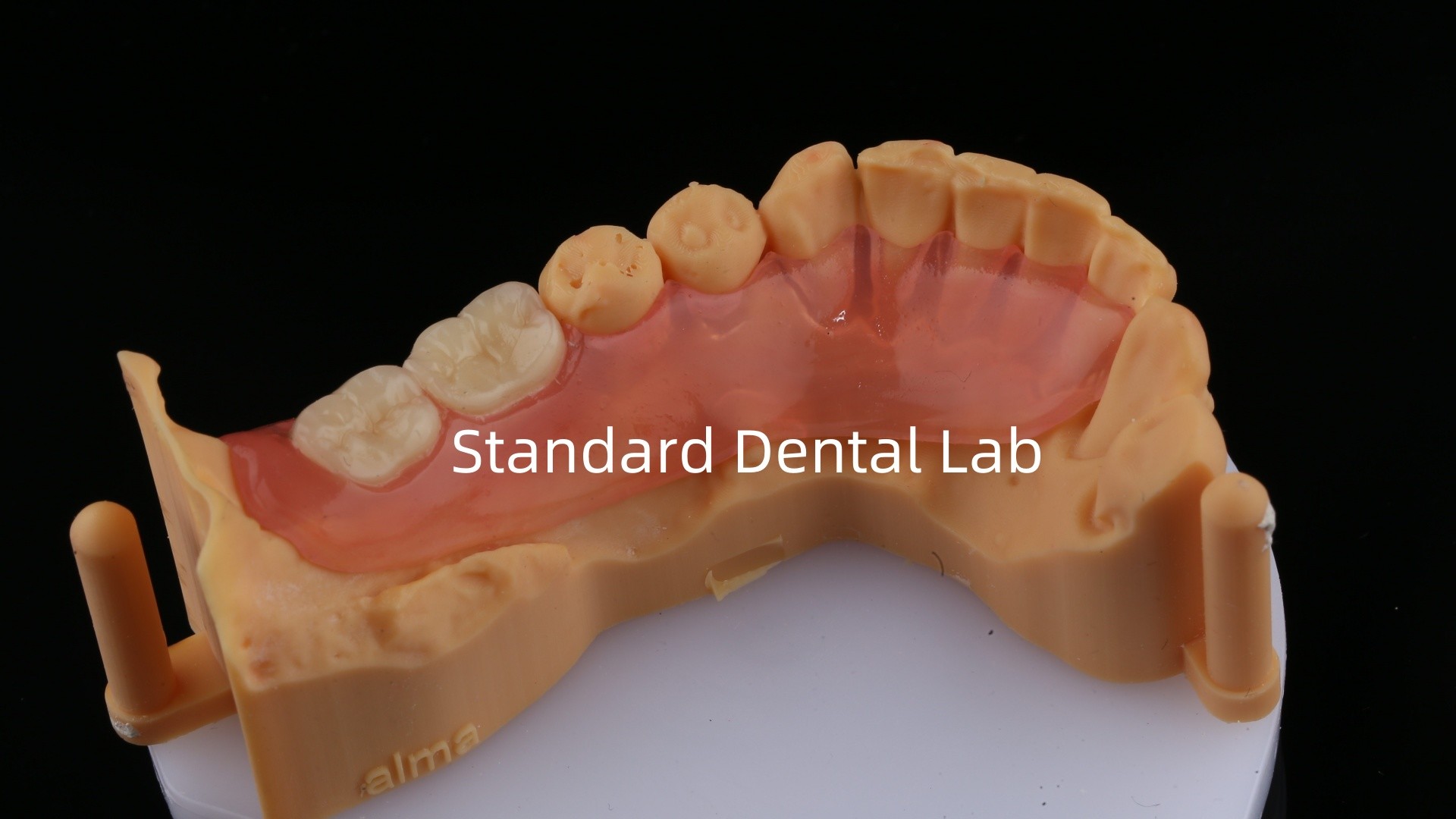 Ace Teeth Pink/Dark TCS Valplast Flexible Partial Dentures for High Esthetics Dental 3D Print Model