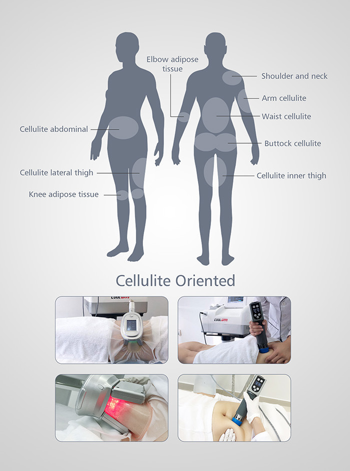 Skin Tightening ESWT Cryolipolysis Fat Freezing Machine With Shock Wave