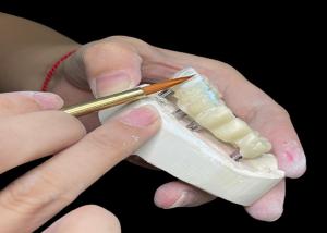 China Customizable Polished Dental Implant Crown Bridge Long Lasting for Easy Hygiene wholesale
