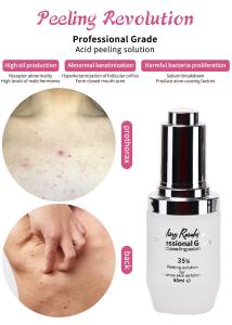 China Exfoliating Serum Skin Peeling Solution Acne Remover Skin Care Skin Peeling 30ml wholesale