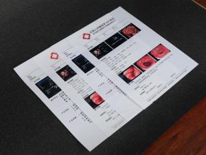 China A4 A3 13X17 PET X Ray Film White Inkjet Medical Dry Film For Epson Printer wholesale