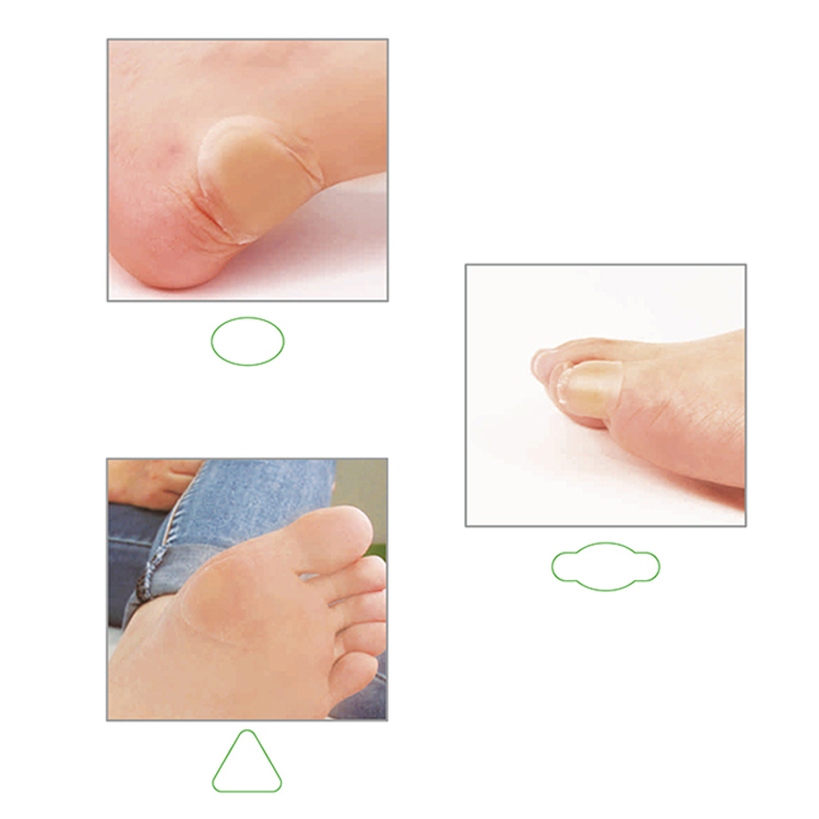Disposable Medical Kind Removal Foot Care Adhesive Hydrocolloid Plaster