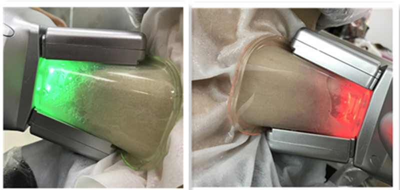 Cryolipolysis Fat Freezing Machine Cryo Lipolysis device With Double Chin handle