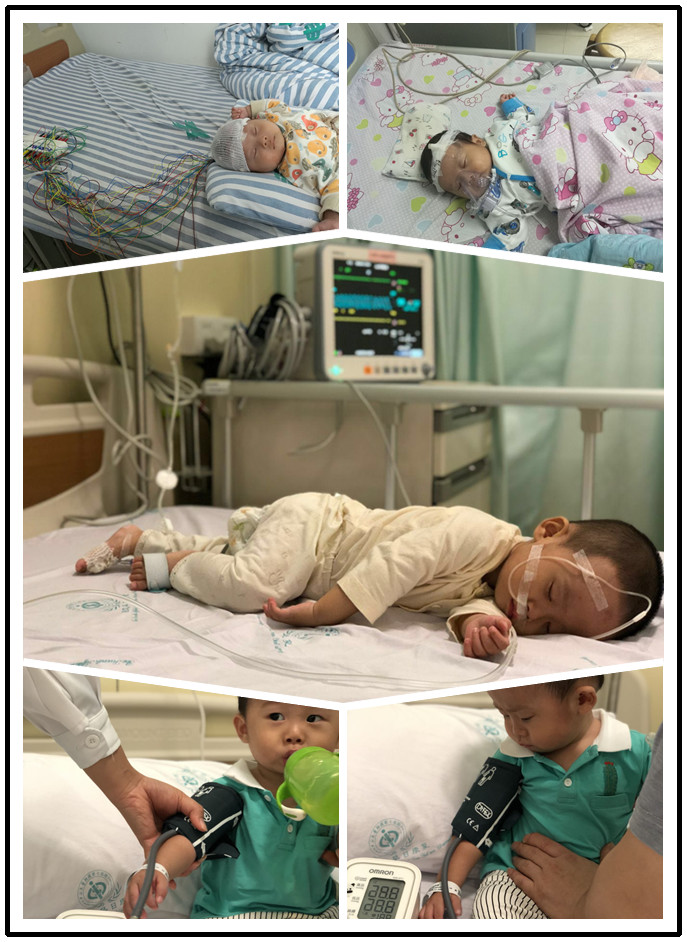 ISO13485 EKG Electrode Banana To Snap Adapter For Patient Monitor