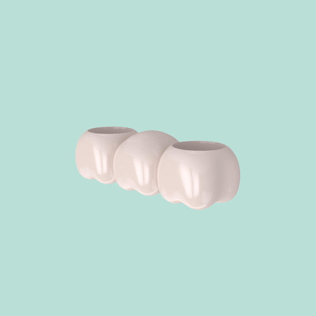 Porcelain Dental Crown Porcelain Dental Bridge For Natural-Looking Results