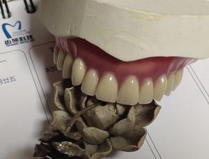 China Complete Denture Permanent Esthetics Acrylic Partial Denture wholesale