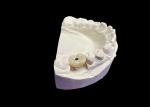 Polished Surface Dental Implant Screw Retained Crown For Tooth Replacement