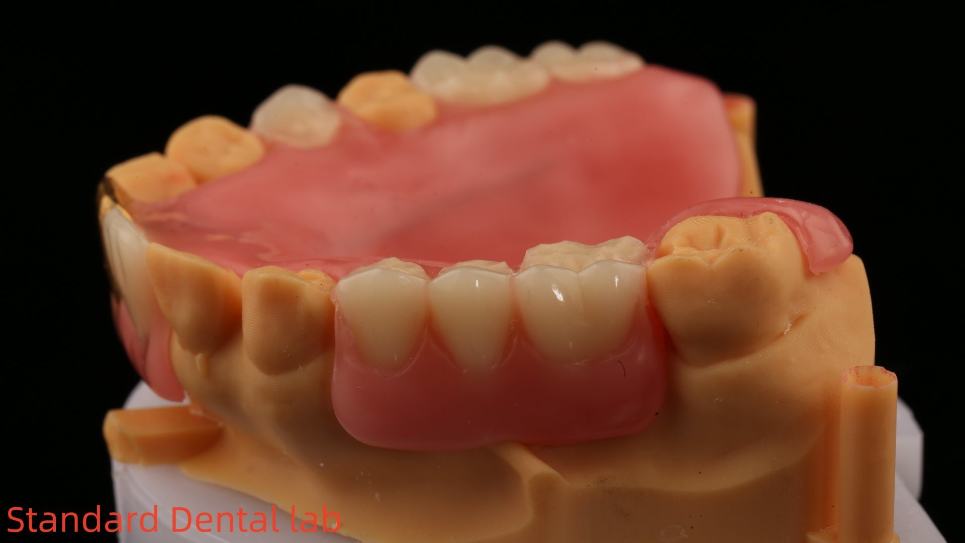 Full Acrylic Dentures With Yellow Gold Teeth/Dental Temporary Acrylic Denture Ivoclar Professional FDA Approved