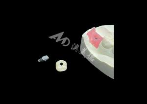 China Long-lasting Dental Implant Crowns Revolutionizing Restorative Dentistry Procedure wholesale