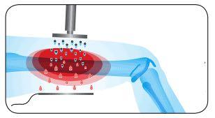 Smart Tecar Therapy Microwave Diathermy Equipment For body Muscle Relax/Heat Treatment Machine