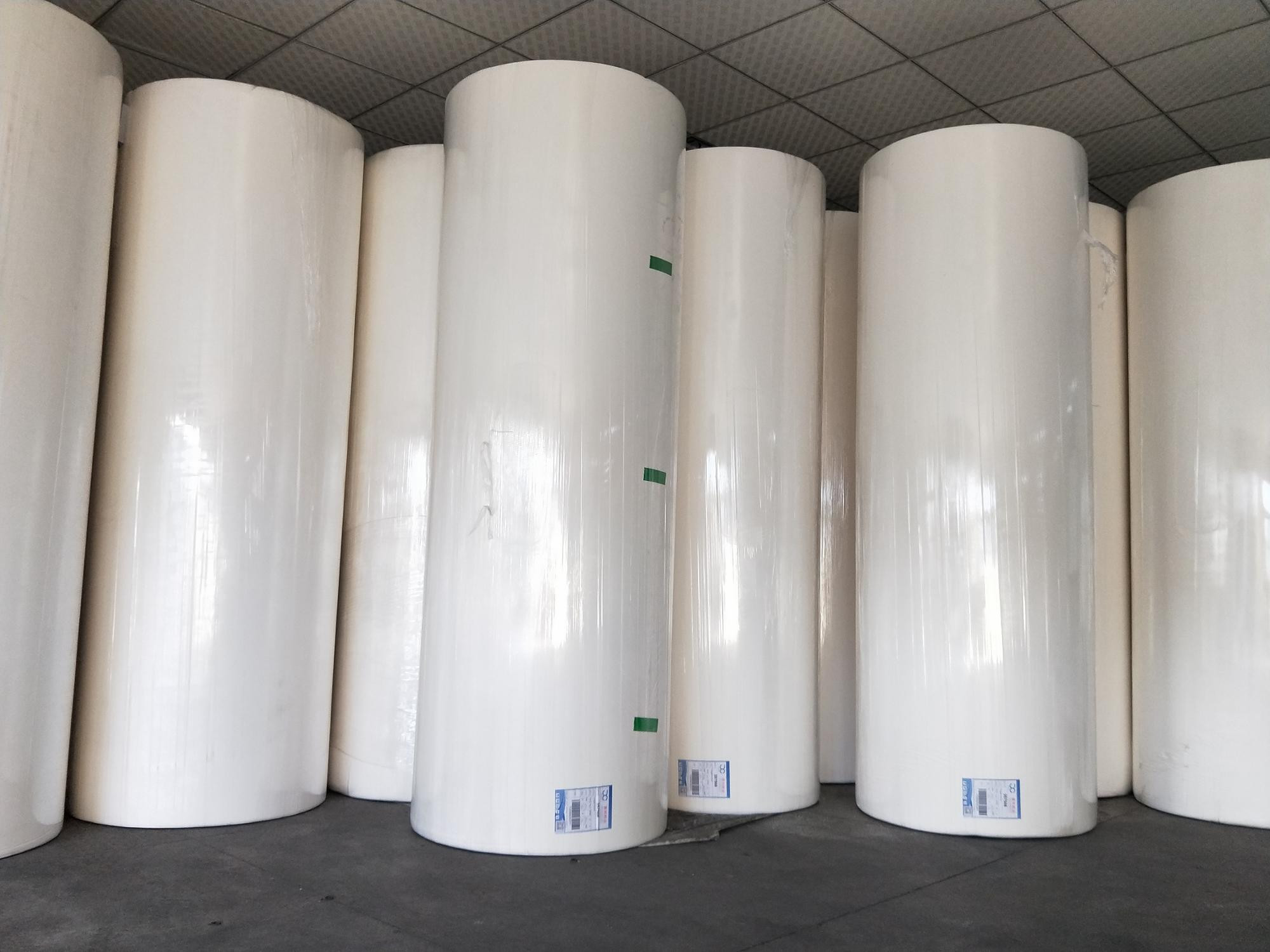 260cm Width Wood Pulp Disposable Surgical Towels
