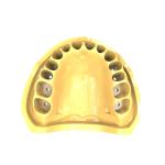 Denture Repair Flexible Resin 3d Printing Orange Flexible 3d Printer Resin