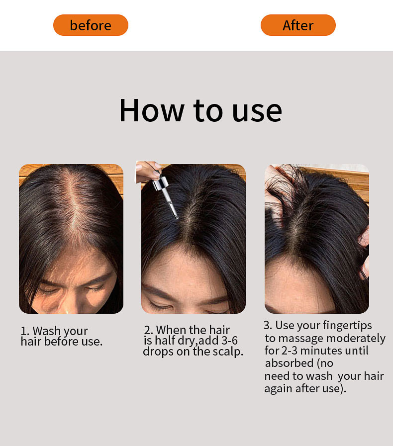 30ml Hair Growth Serum