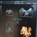Medical Device Repair Cases OF GE RIC5-9-D ULTRASOUND PROBE FOR REPAIR