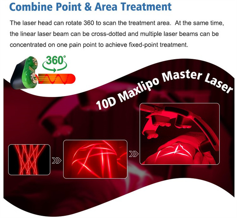 Ems Cooling Plate Laser Weight Loss Machine Maxlipo Master 10d