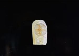 China Super Strength Porcelain Dental Crown High Biological Intermiscibility wholesale