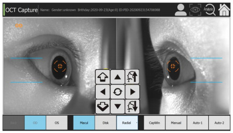 PC Inside Oct Scan Machine 75 Lbs For Fundus Diseases Glaucoma