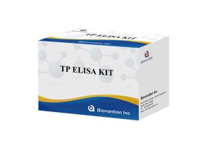 China Hospital, Medical Center,Self High AccuracyAnti-TP ELISA Test Kit wholesale