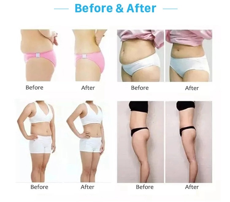 weight loss cellulite reduction double chin fat burn infrared slimming electric body slimming massager