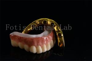 China Affordable All On Six Dental Implants Effective Treatment Easy To Clean wholesale