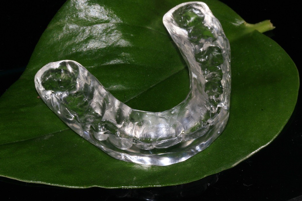 Custom Made Mandibular Arch Stablizing Bite Splint