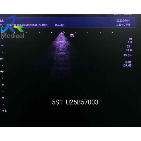 Toshiba PSU-25BT 5S1 Cardiac Array Sector Ultrasound Probe Medical Imaging