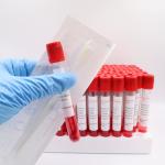 Coronavirus Specimens PET Blood Specimen Tubes 4ml