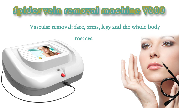 30MHz RBS spider vein removal and skin tag removal device