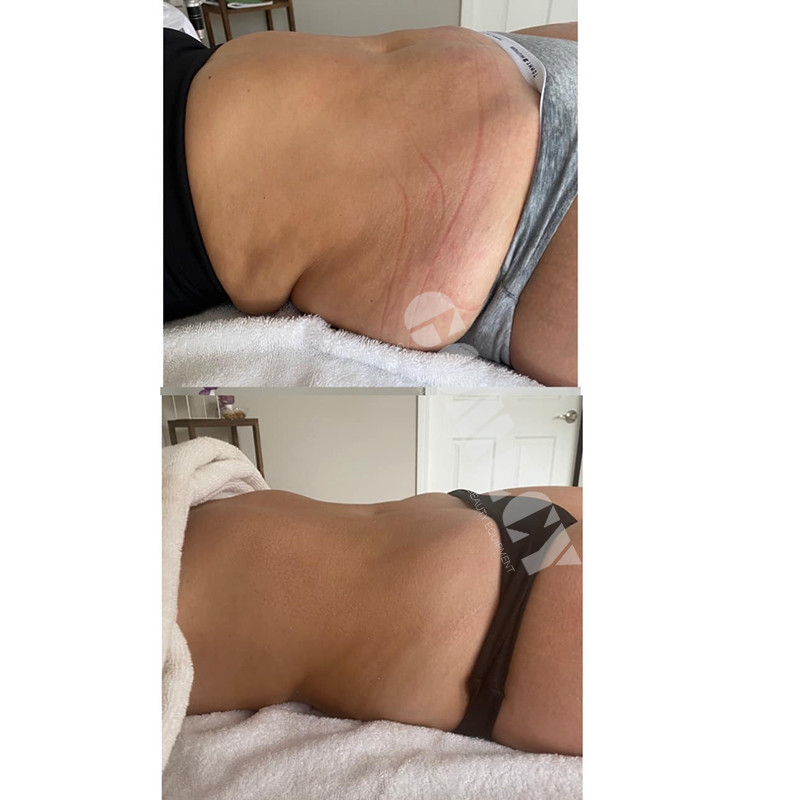 ODM OEM Lipo Laser Fat Reduction Machine With Air Cooling / Wind Cooling System