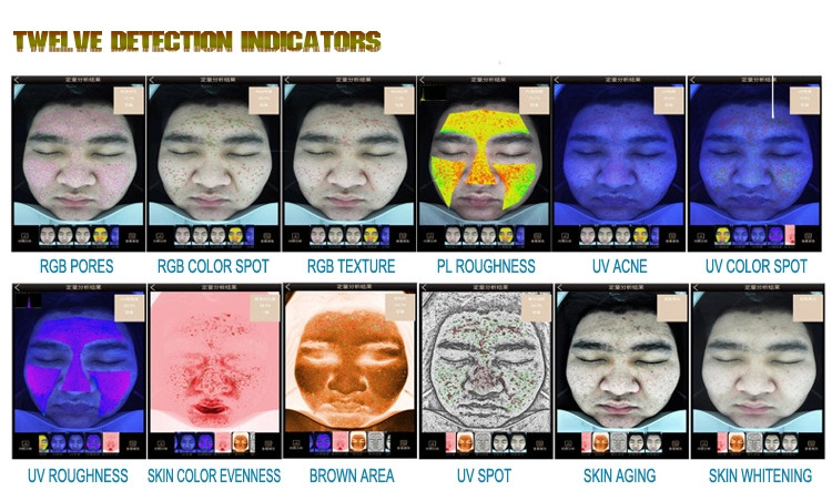 Precise Skin Hydration Analyzer Using RGB UV PL Spectral Imaging Technology