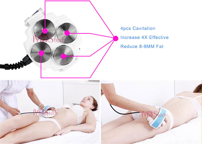 Ultrasonic Cavitation RF Machine