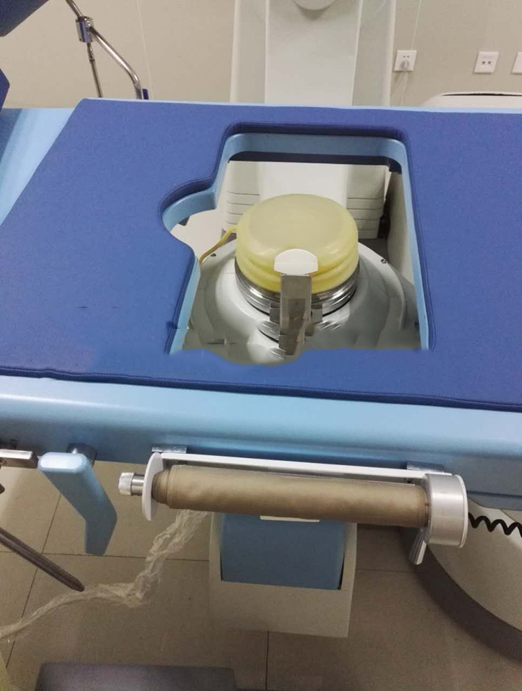 hot selling China ESWL lithotripter machine for sale