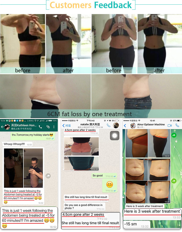 cryotherapy and weight loss unique double chin treatment cryolipolysis cellulite reduce machine
