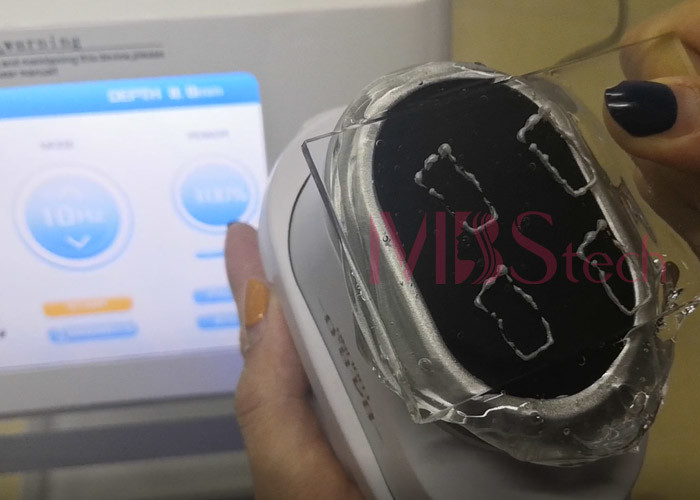 5 Cooling Cartridges Cold Skin Painless Face Lifting 5D HIFU