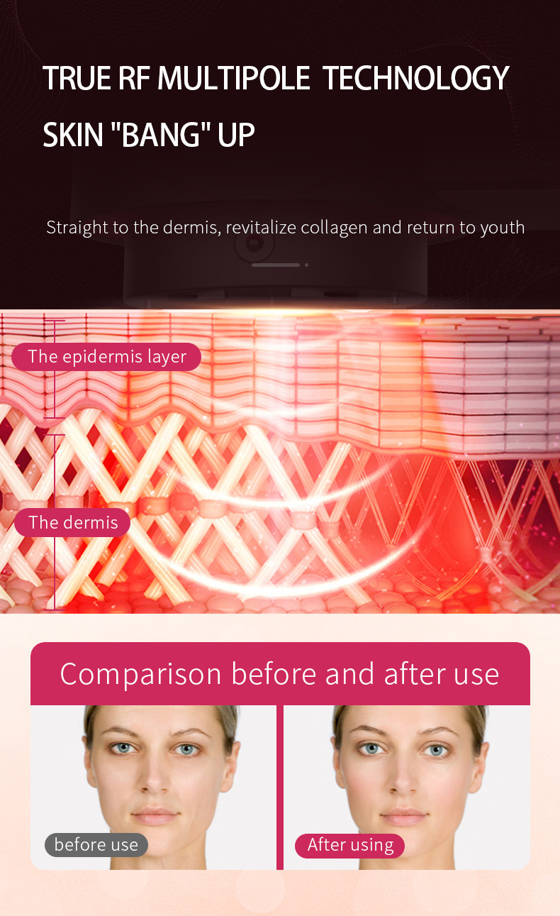 Collagen Regeneration 90Khz RF Facial Toning Device