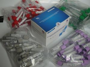 China Tuberculosis-Interferon Gamma Release Assay Elisa kit Manufactured by Biovantion wholesale