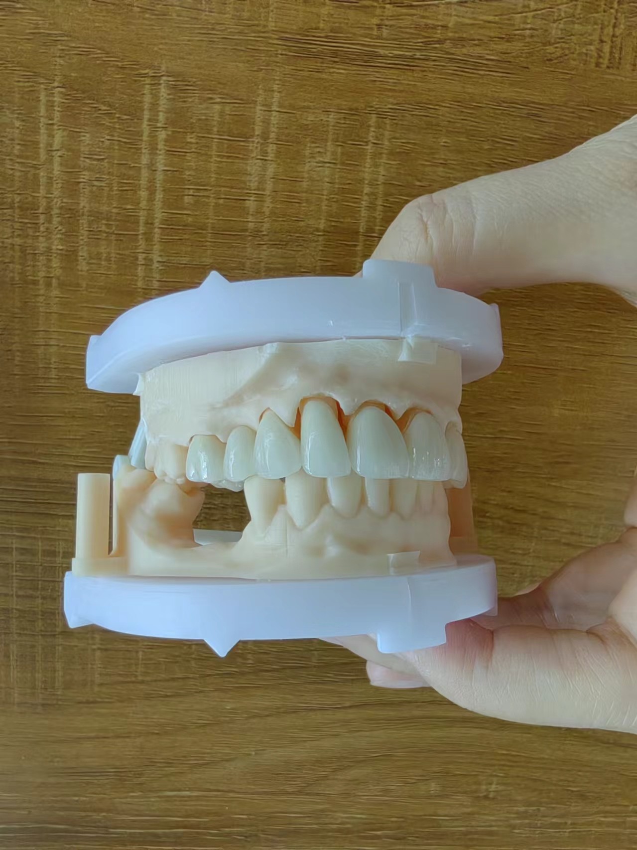Translucent Layered Zirconia Crown Dental Restoration Multilayer Zirconia Crown