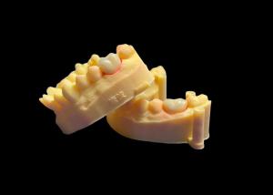 China Premium Zirconia Porcelain Dental Crown Unmatched Strength Precision Fit and Exceptional Aesthetics and Durability wholesale