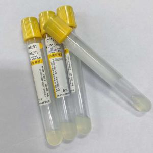 China 5ml SST Gel Clot Activator Blood Collection Tube Yellow Cap wholesale